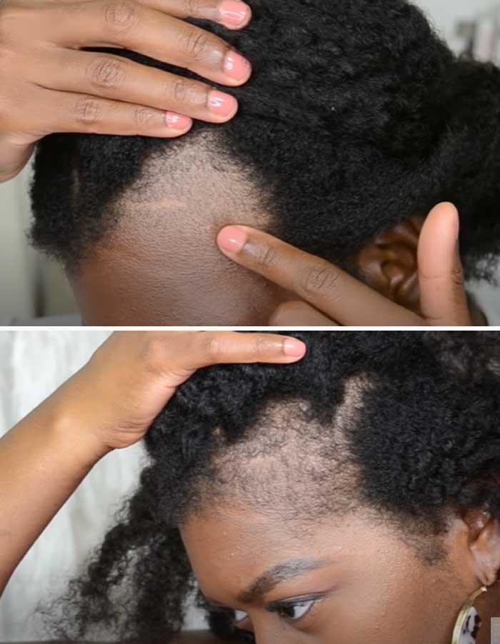 Vicks For Hair Growth Should Your Try Or Steer Clear