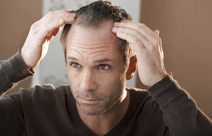 Finasteride may help reduce hair loss in men