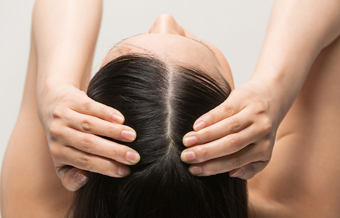 Woman revealing a healthy scalp afer taking fish oil regularly