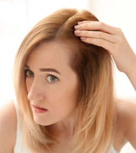 Lupus Hair Loss Causes, Types, Symptoms, And Treatment