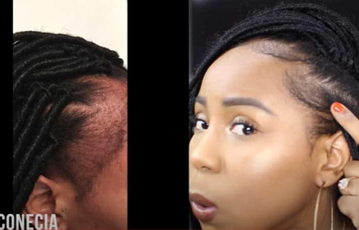 Black Women Are Using Vicks VapoRub On Their Edges And Hair To Make It GrowDoes  It Work  Essence