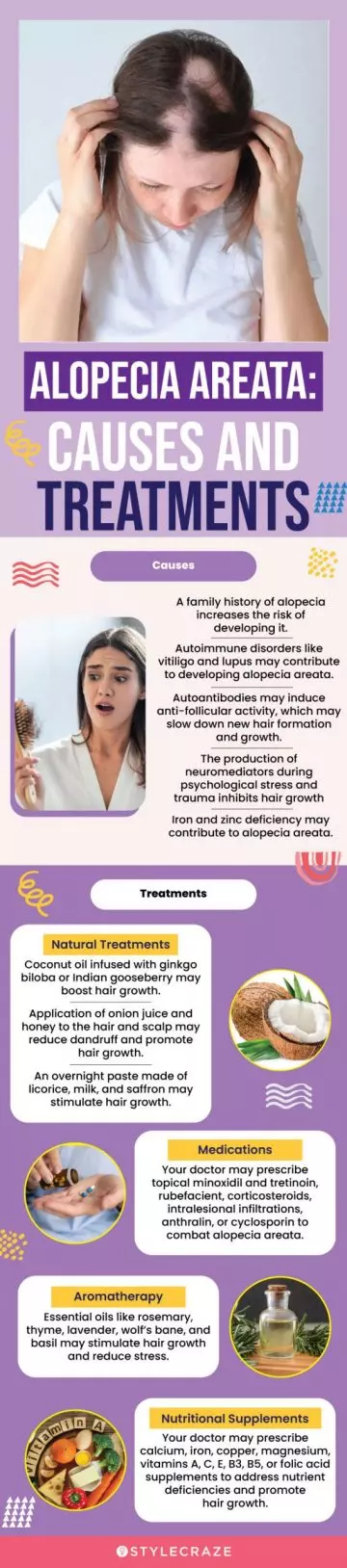 alopecia areata: causes and treatments (infographic)