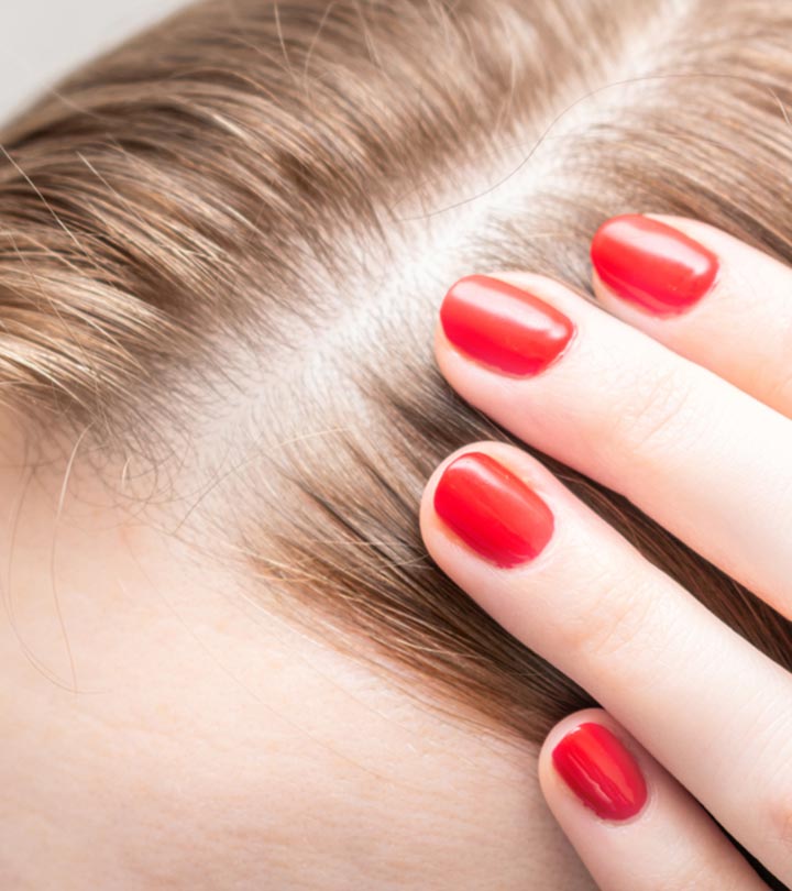 Signs Of Hair Thinning And How To Treat It
