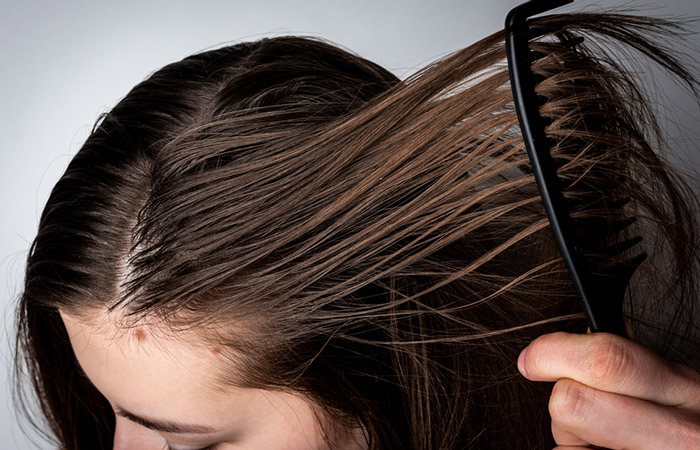 Woman experiencing greasy scalp as a side effect of high-frequency hair treatment