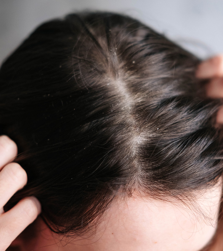 How To Get Rid Of Scalp Buildup Effectively