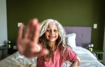 Little girl has patchy white hair as a result of vitiligo
