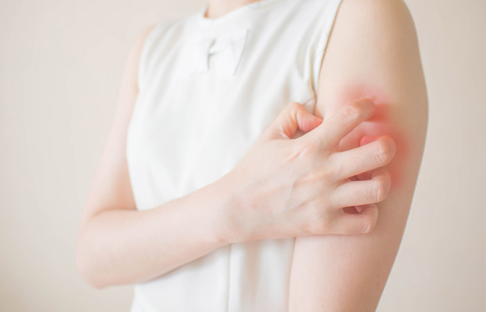Castor oil may soothe eczema