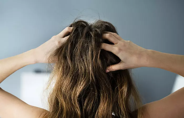 Woman with an itchy scalp due to buildup