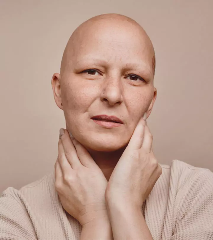 Alopecia Totalis – Causes, Symptoms, Treatment, And Risks