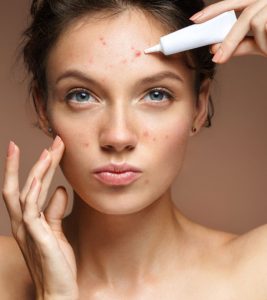 15 Best Acne Products Of 2022 - Detailed ...