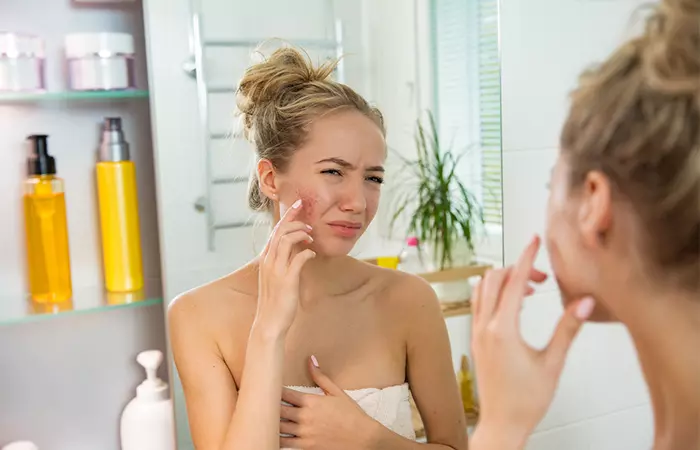 Don’t Do Anything That Will Further Irritate Your Skin