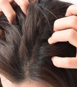 How To Stop Scalp Itching At Night