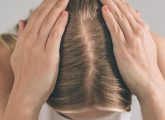 PCOS Hair Loss: Causes, Signs, Treatment, Remedies, And More
