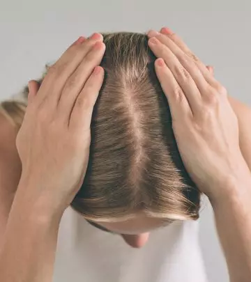 PCOS Hair Loss: Everything You Need To Know