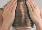 PCOS Hair Loss: Causes, Signs, Treatm...
