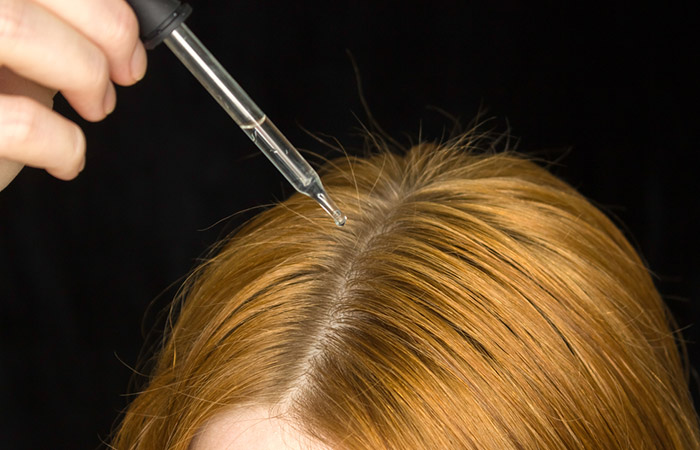 Woman applying minoxidil to avoid hair loss
