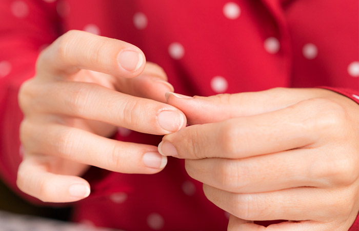 Woman holding her thinning fingernails which can be an early indicator of ophiasis alopecia