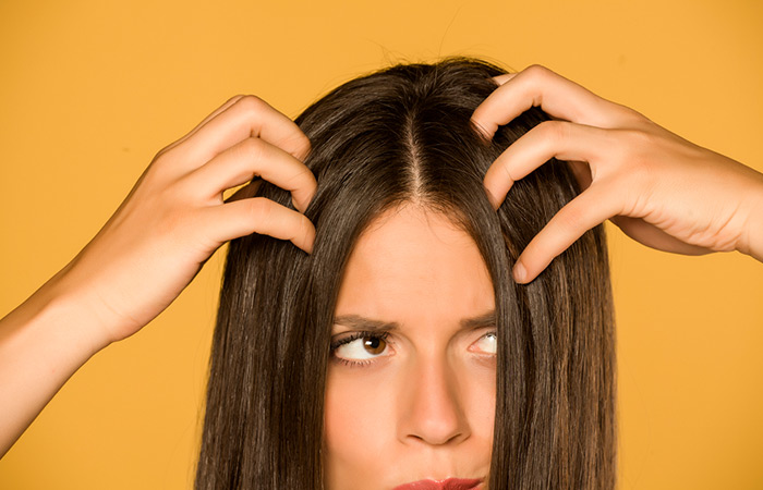 Woman with itchy and irritated scalp