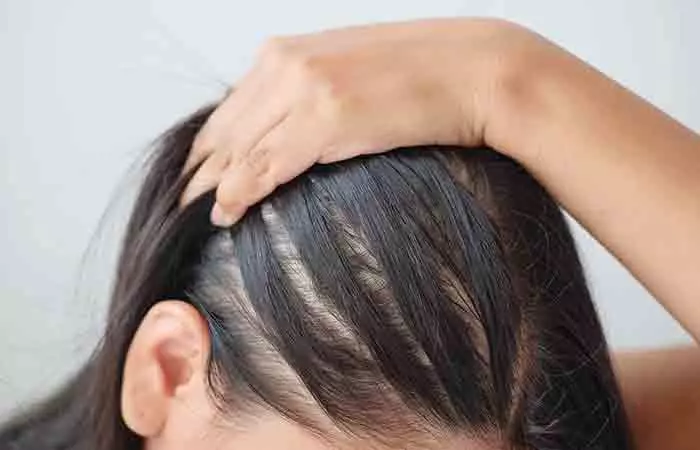 People with thin hair should use topical hair fibers