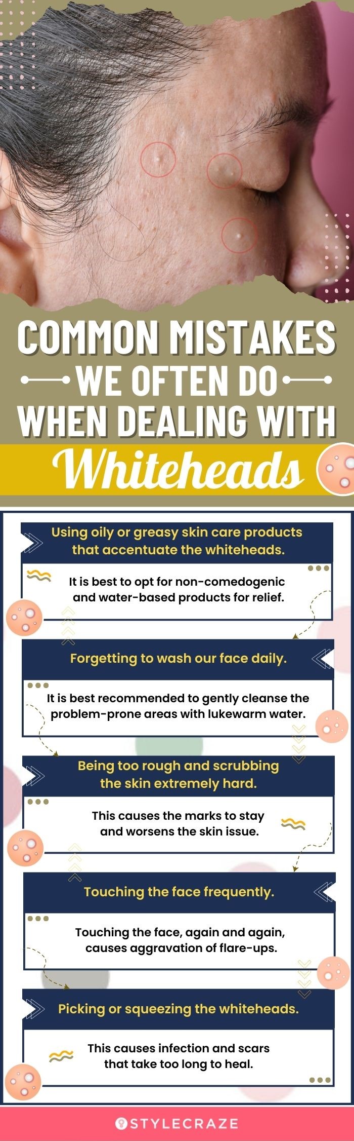 Common Mistakes We Often Do When Dealing With Whiteheads(infographic)