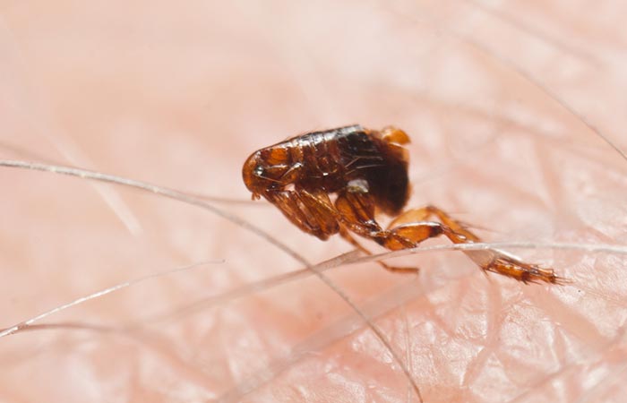 Fleas In Human Hair: Treatments And Home Remedies