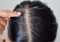 How Do You Treat A Dry Scalp And Oily...