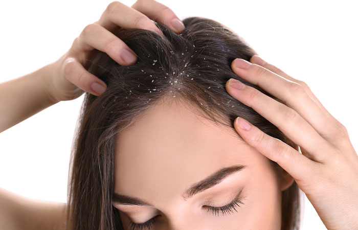 Woman with a healthy scalp pH due to chebe powder