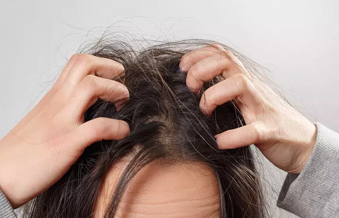 Woman with itchy scalp after using tea tree oil