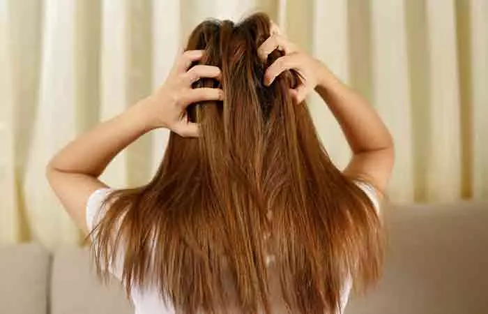 Woman experiencing allergic reactions on her scalp after using ketoconazole shampoo