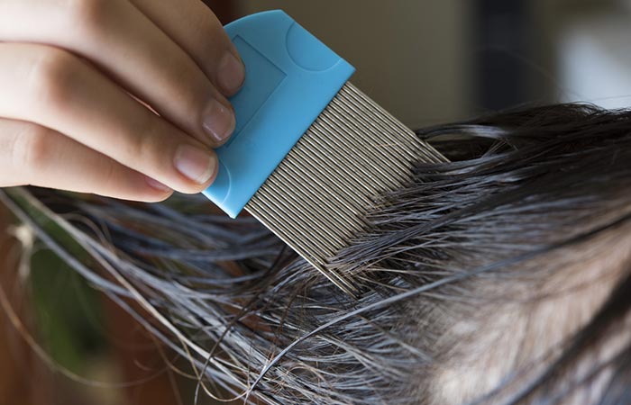 Closeup of person using lice comb on lice infested hair