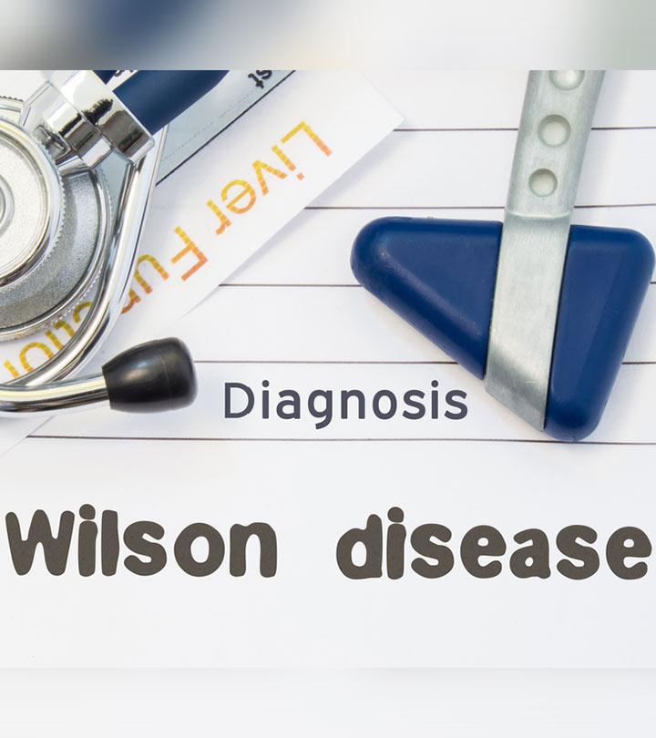 উইলসন রোগ – কারন, লক্ষন, চিকিৎসা | Wilson Disease in Bengali