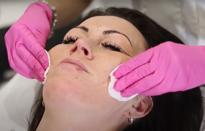 Carbon laser peel facial step 1