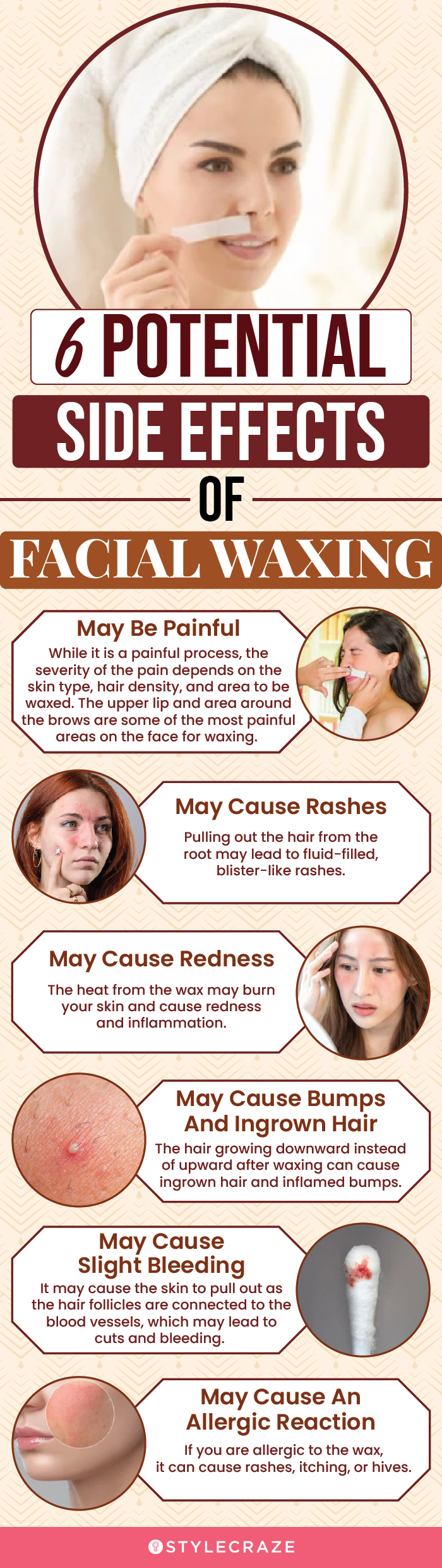 6 potential side effects of facial waxing(infographic)