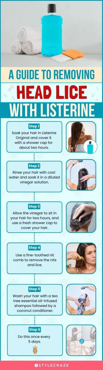 a guide to removing head lice with listerine (infographic)