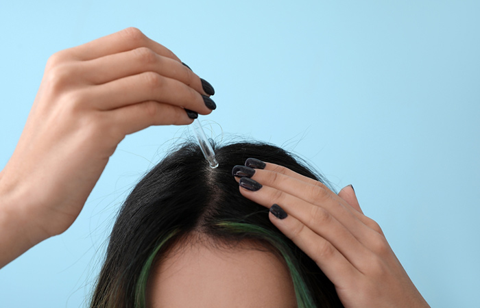 Woman applying antifungal serum to scalp