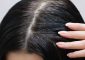 सफेद बालों के लिए आंवला के फायदे और उपयोग – Benefits of Amla for Hair ...