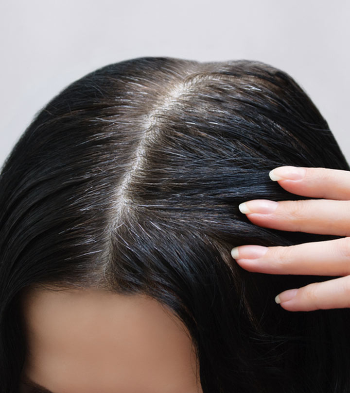 सफेद बालों के लिए आंवला के फायदे और उपयोग – Benefits of Amla for Hair in Hindi