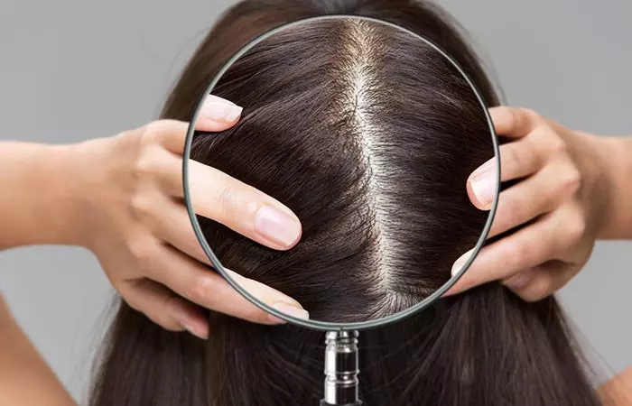 Close up of dark spots on a woman's scalp as a sign of new hair growth