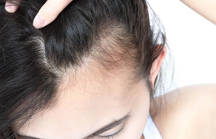 Close up of baby hair strands on a woman's scalp as a sign of new hair growth