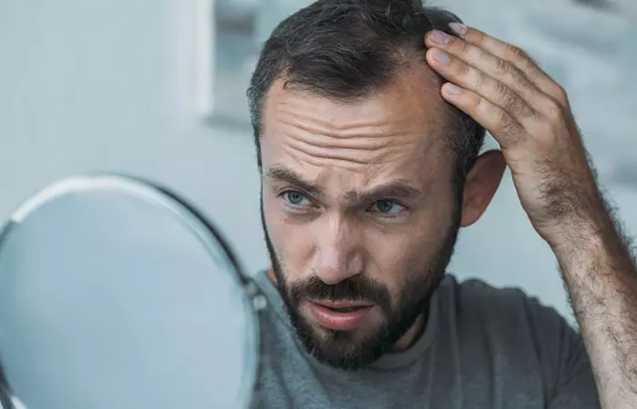 Appearance of peach fuzz on the man's scalp as a sign of new hair growth