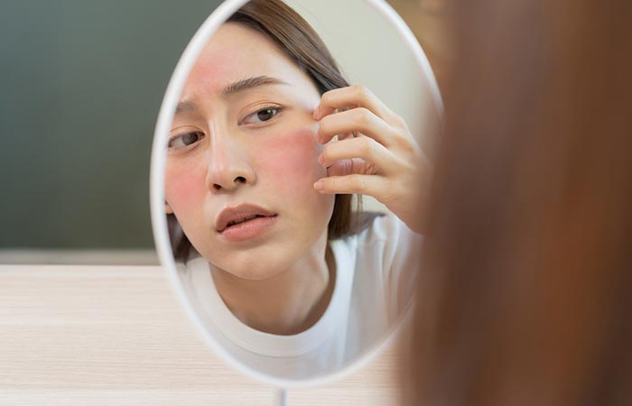 Woman with sensitive skin may benefit from mandelic acid
