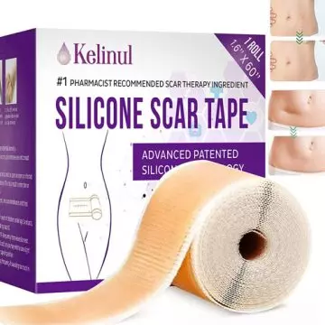 Kelinul Medical-Grade Silicone Scar Tape