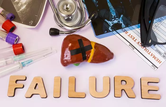 Liver Failure