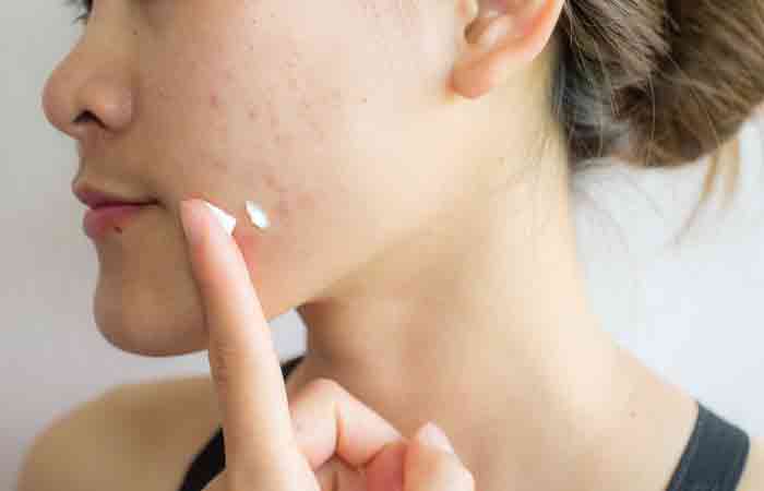 A woman applying Neosporin for acne