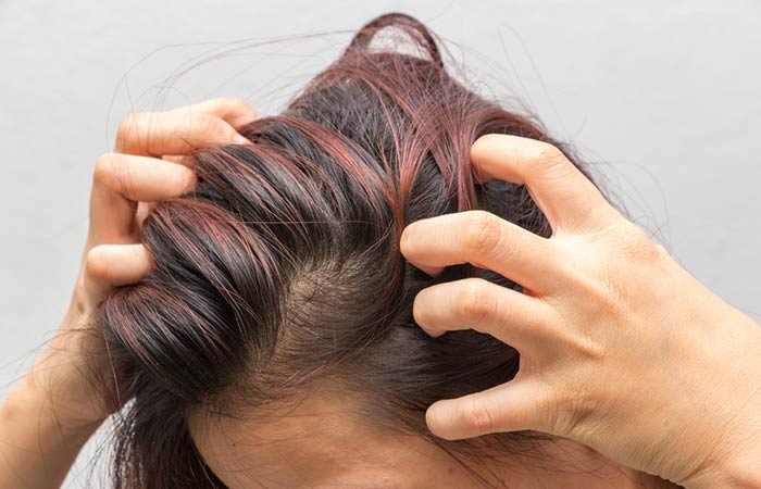 Pruritus scalp problem
