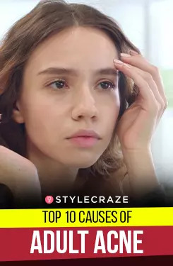 Top 10 Causes Of Adult Acne