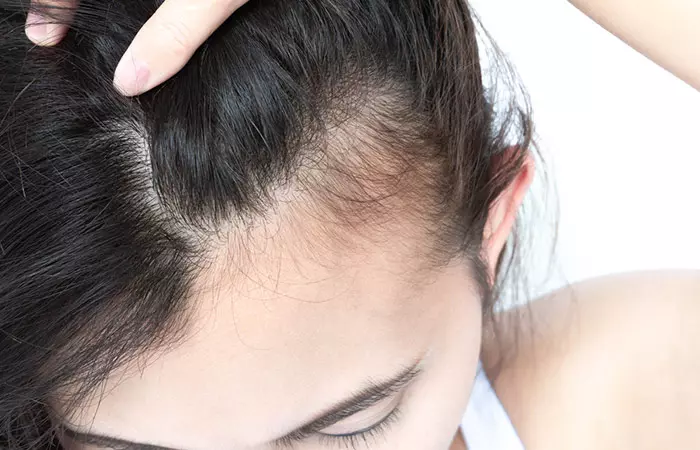Close-up of baby hairs on a woman's scalp
