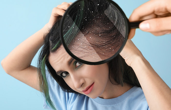 Woman looking at her dandruff to understand its cause