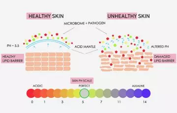 What damages the skin barrier