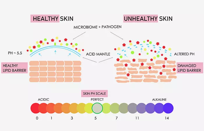 What damages the skin barrier